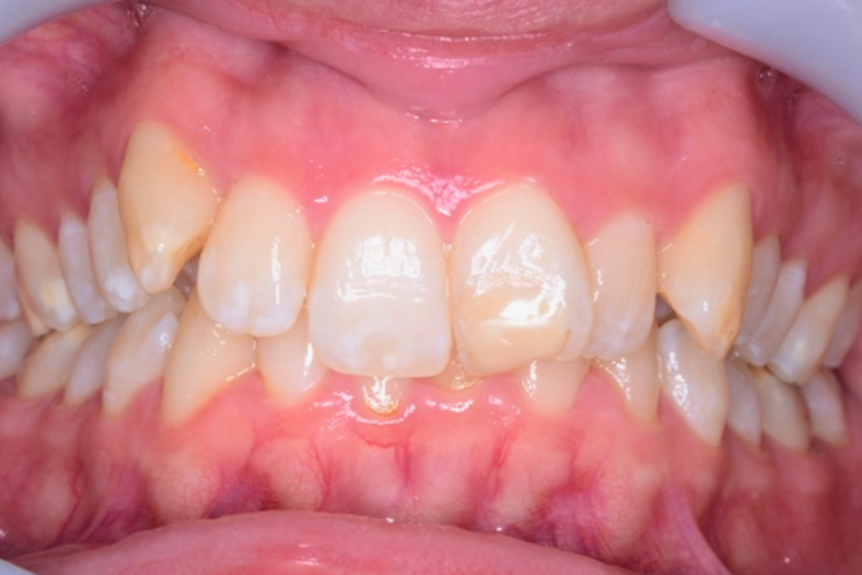 Before - The Edge Dental